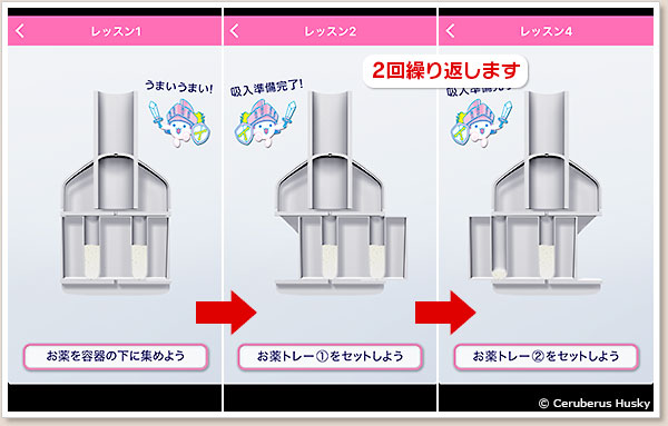 容器の構造
